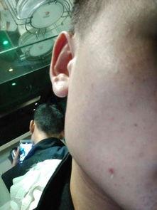 脸过敏可以吃哈密瓜不,过敏人群的禁忌之选? 第3张 脸过敏可以吃哈密瓜不,过敏人群的禁忌之选? 第3张